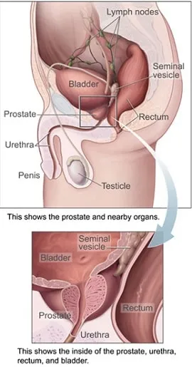 Prostate_img